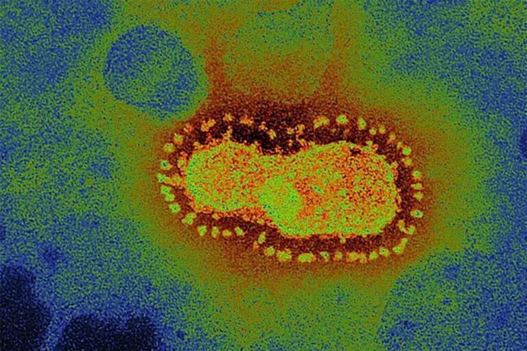 Coronavirus, 8 nuovi casi nel Pordenonese